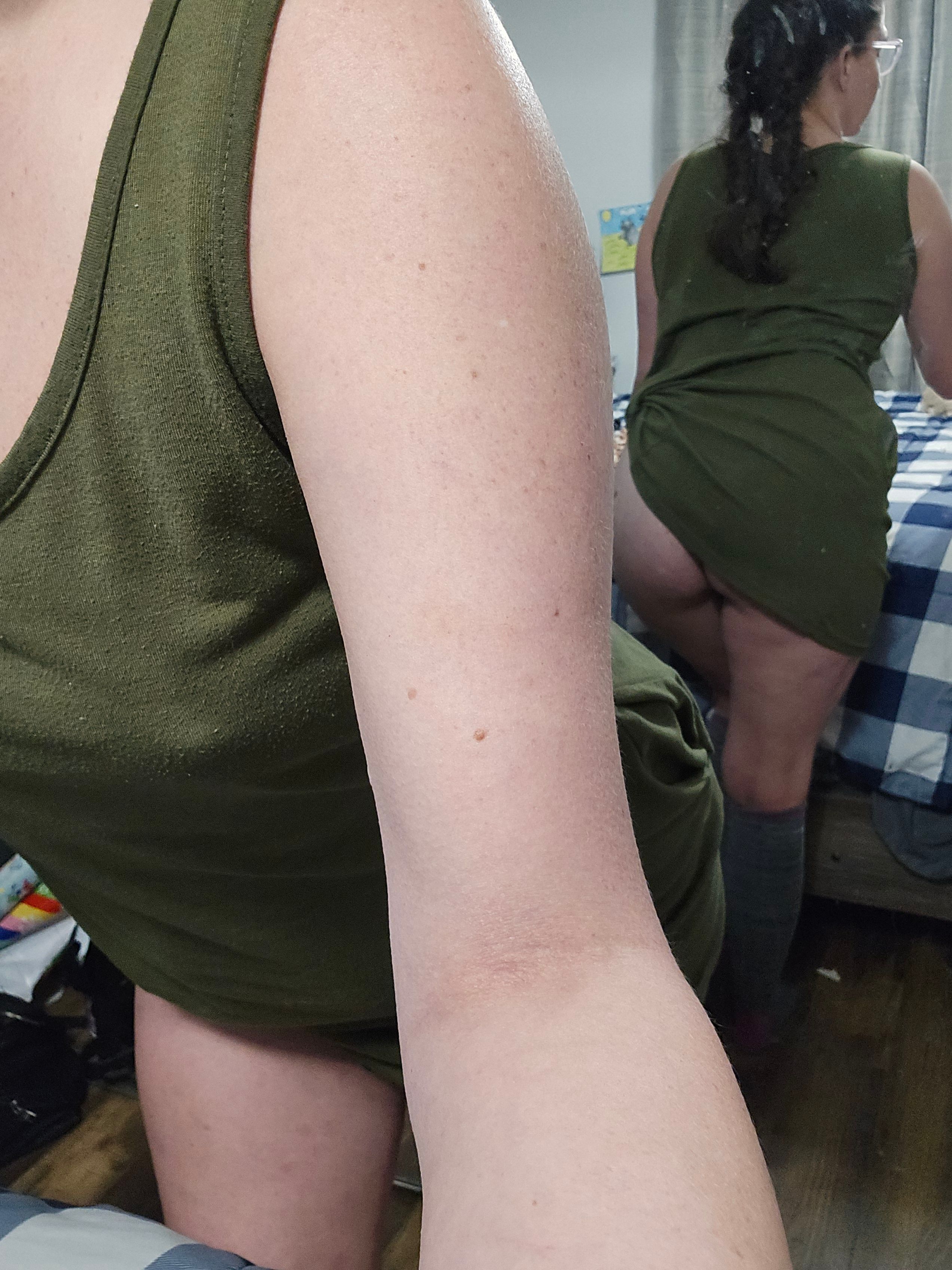 mv