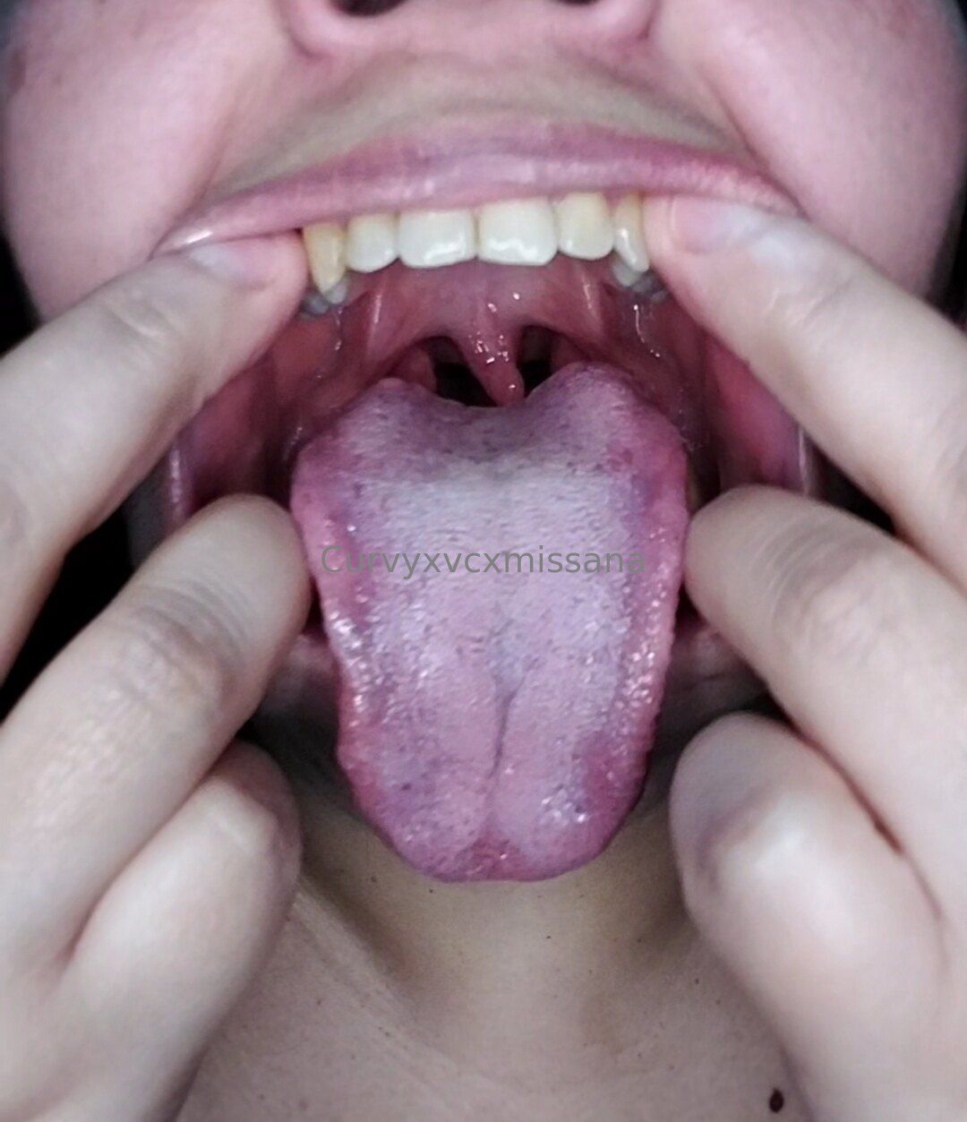 mv