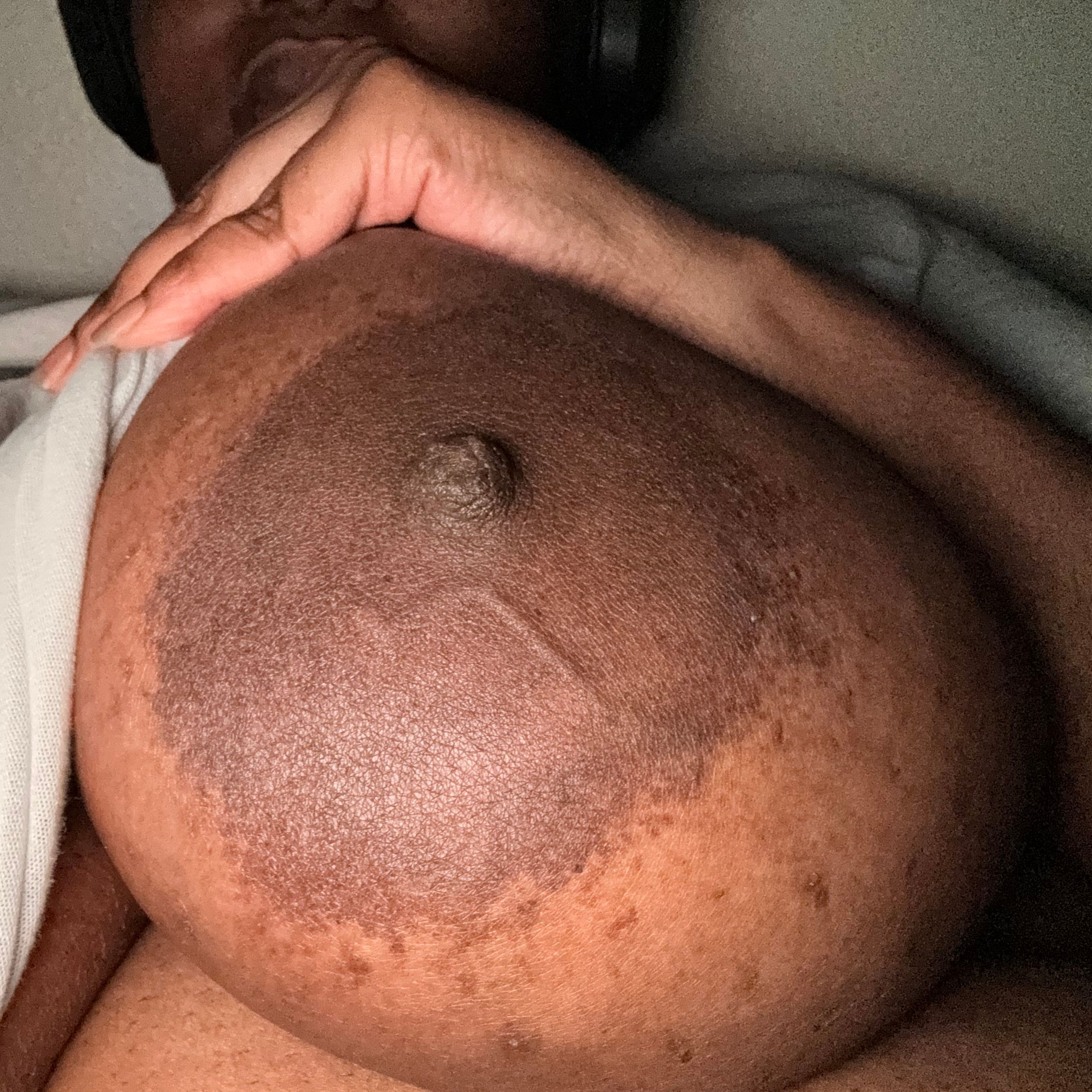 mv