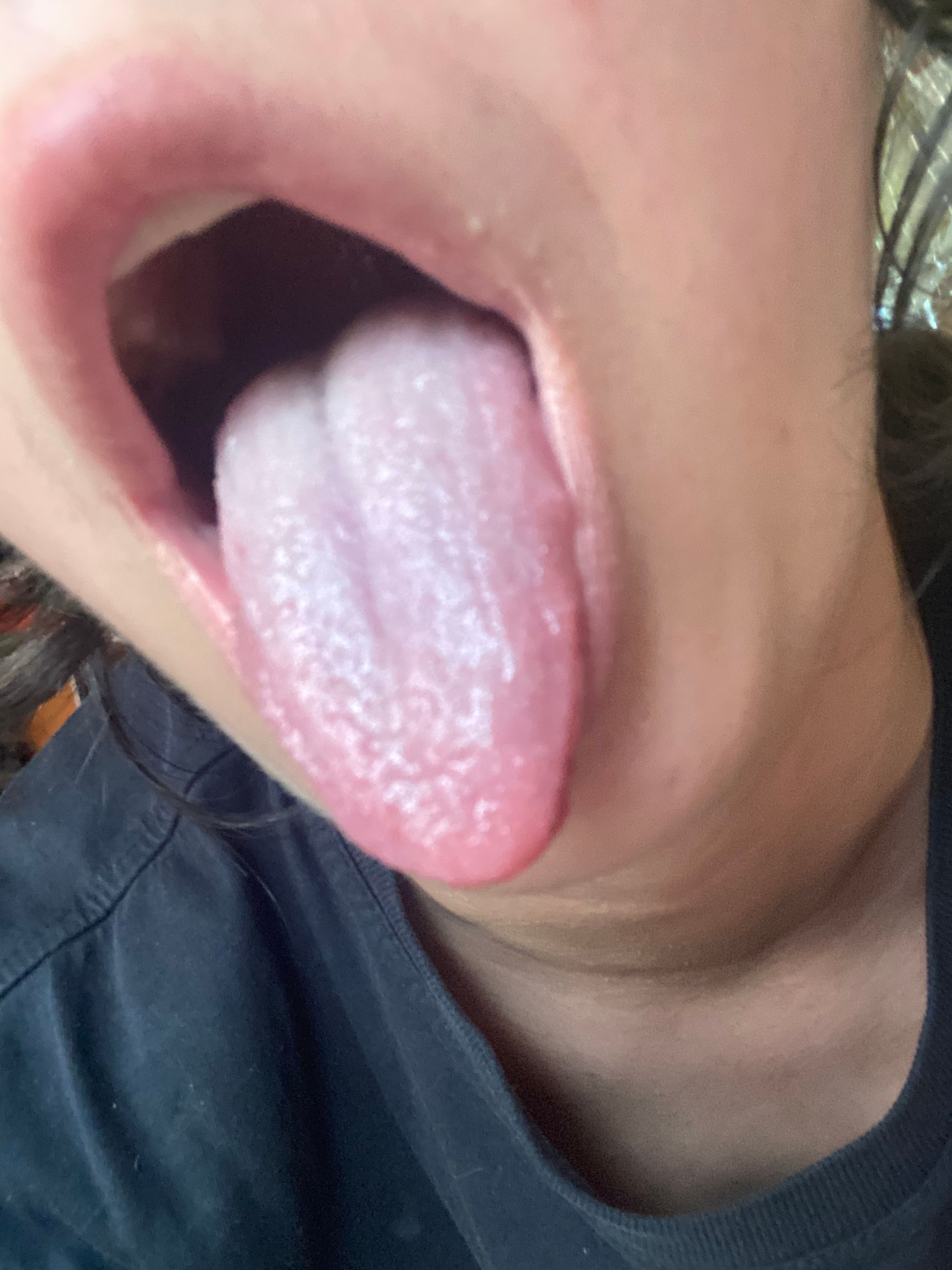 mv