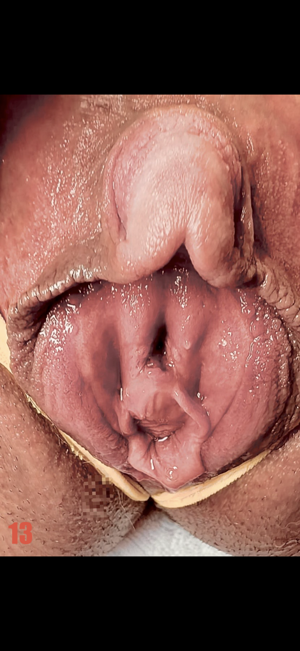 mv