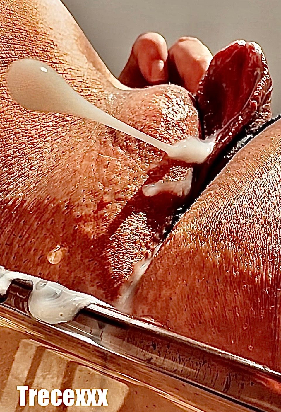 mv