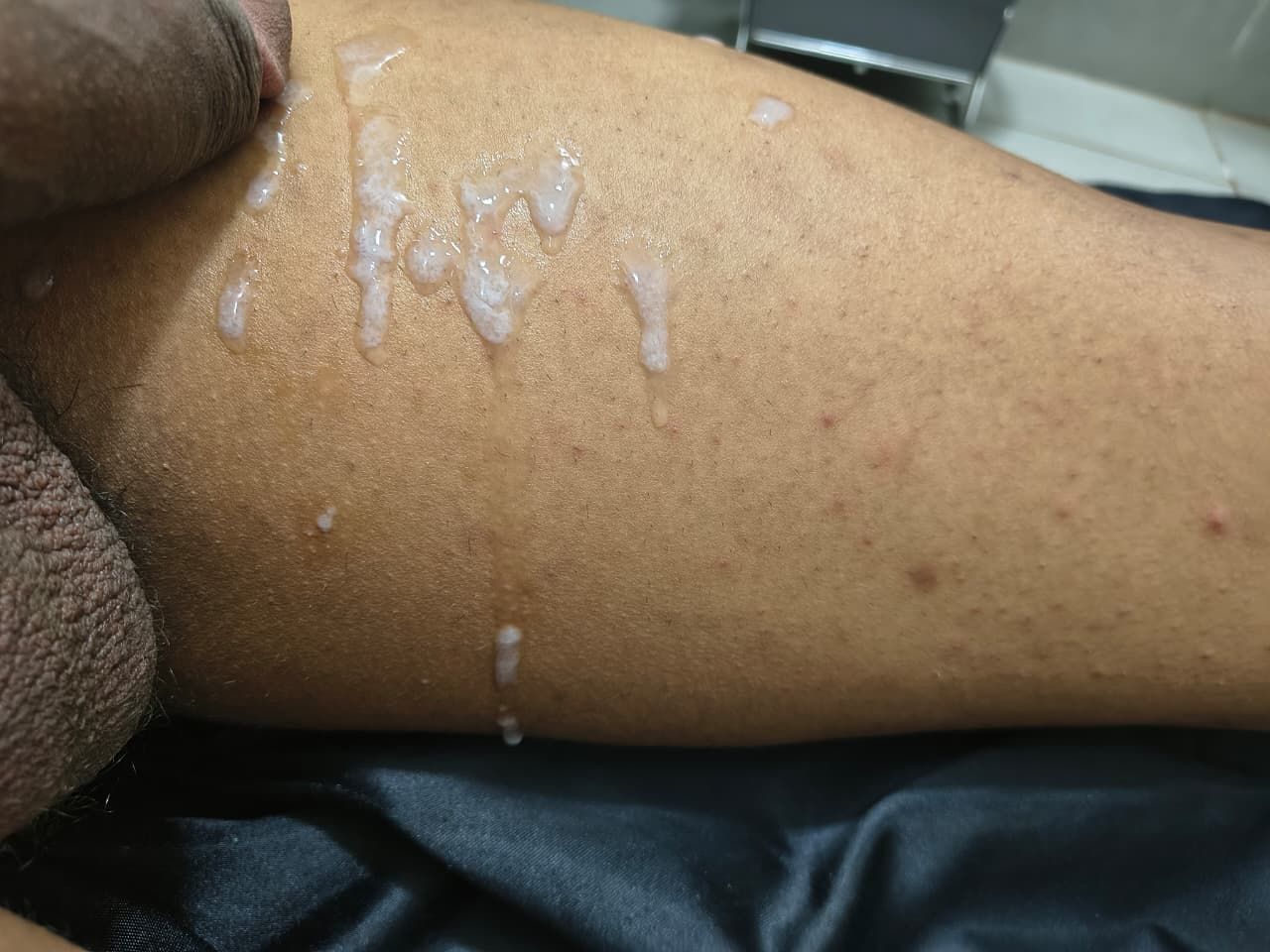 mv